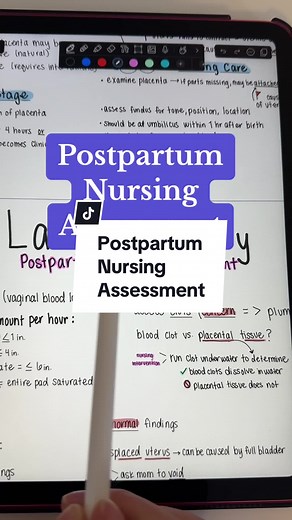 Labor and Delivery Postpartum Nursing Assessment for nursing students. #nursingschool #nursingstudent #laboranddeliverynurse #nursingstudenttips #nursingnotes #studytips #laboranddelivery #nursesoftiktok