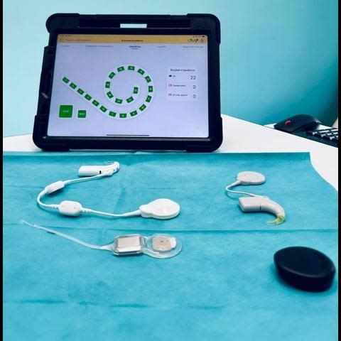 "L'ADIGE.IT" * ATTUALITÀ: «AL POLICLINICO DI BARI IMPIANTO COCLEARE SMART, BIMBO DI 11 RECUPERA UDITO» - Agenzia giornalistica Opinione. Notizie da Italia - Mondo / Trentino Alto Adige