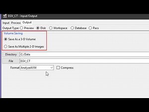 Analyze 14.0 - Input/Output: Saving Data