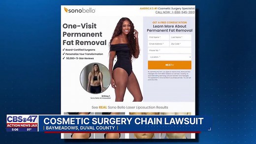 Local attorney details Sono Bello cosmetic surgery malpractice lawsuits