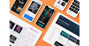 Clarius Marketplace Unlocks the Power of AI Innovation for Ultrasound Imaging