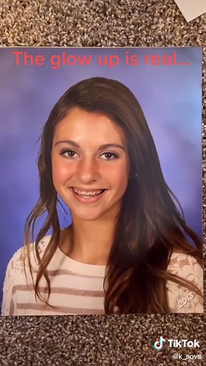 After 10 years I finally got rid of the unibrow