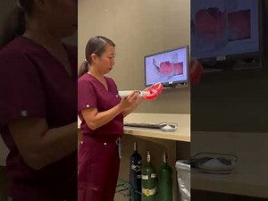 How to Use the Trios Scanner