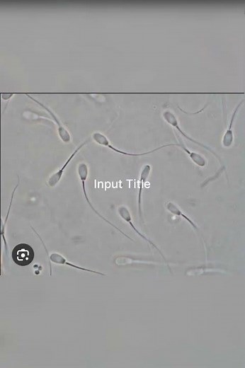 Sperm cell morphology and sperm under microscope