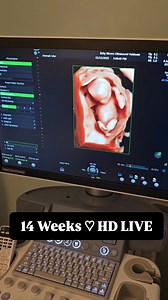 1.4K views | 14 Weeks ♡ HD Live Ultrasound! We loved watching this sweet baby move around during his scan at Baby Bloom today! | Baby Bloom HD Ultrasound Studio & Maternity Boutique | Facebook