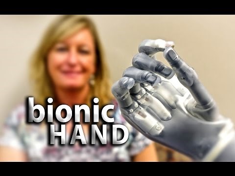 i-Limb Bionic Hand is a Game Changer for Amputees