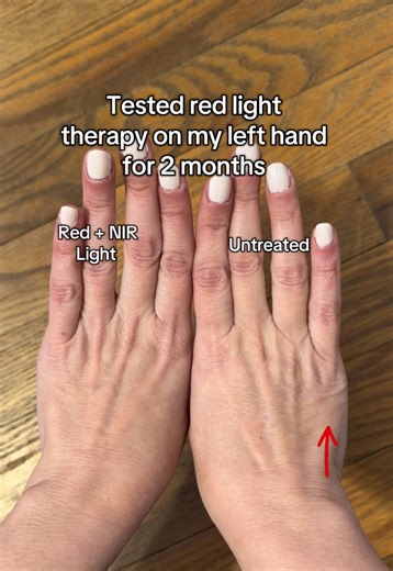 I’ll do a full update soon, but here’s a preview! I wanted to do a longer term experiment, and I definitely think I’m seeing a difference in the red light therapy treated hand. #womeninstem #redlighttherapy #antiaging #experiments