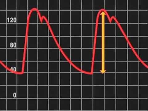 What is Pulse Pressure ?