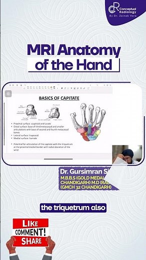 MRI Anatomy Of the Hand by Dr. Gurusimran Singh Anand | Radiology Residency | Conceptual Residency
