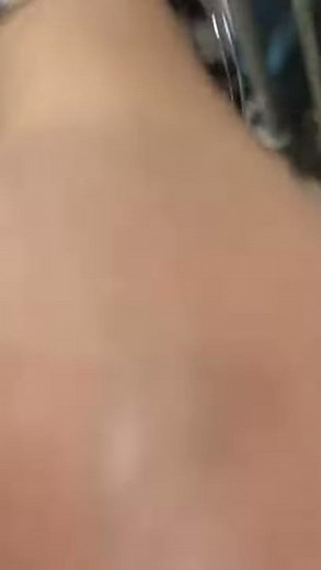 How to Use Lancet Safety Pro | Step-by-Step Demo for Nurses