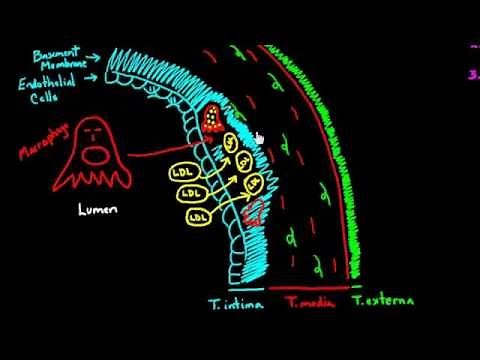 Atherosclerosis - Part 1