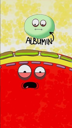 Nephrotic Syndrome Explained | Podocyte Injury → Proteinuria