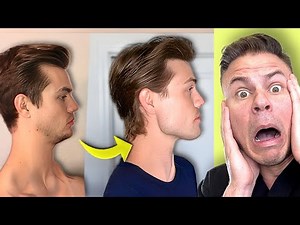 Dentist Reacts to "How I Fixed My Receding Chin"