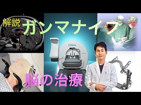 解説！ガンマナイフの進化〜転移性脳腫瘍の放射線治療〜