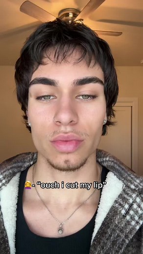 Dealing with a Cut Lip: What to Do