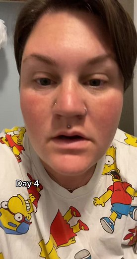 #day4 #newpiercing #tonguepierced #healingprocess #fypシ #bloodblister #tongue