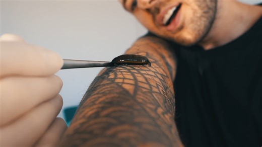 He tried leech therapy in Poland and this is what happened to his body