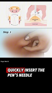 How to inject insulin There are different ways to take insulin, including syringes, insulin pens, insulin pumps, and jet injectors. Your doctor will help you decide which technique is best for you. Syringes remain a common method of insulin delivery. They’re the least expensive option, and most insurance companies cover them. | Med G