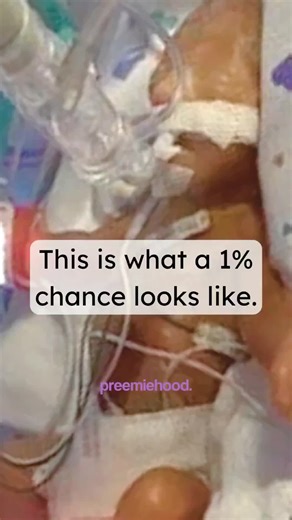 I would have traded places with my boys in less than a heartbeat. To this day I can't stand seeing them get hurt or being sick. The trauma runs deep. #birthtrauma #preemiemama #preemiebaby #nicubaby #micropreemie