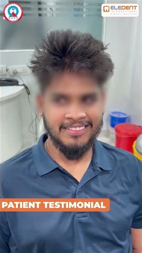 Digital Smile Designing Testimonial | Yellow Teeth to White Smile | Eledent Dental Hospitals
