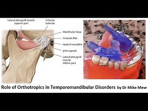 Orthotropics Treatment of Temporomandibular Joint Disorders by Dr Mike Mew