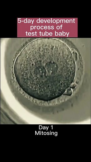 5-day real-time development process of test-tube baby.#undermicroscope #ivf #ttc #fertility #fertilityclinic #ivfbaby #baby #embryo #pregnant #morula #morulaivf