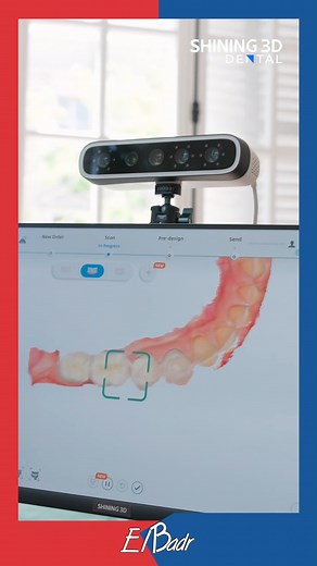 13K views · 32 reactions | Effortless. Smooth. Powerful  Intraoral scanning. The Aoralscan Elite Wireless + e-Motion. No wires. No clutter. Just next-level precision. ✨ Watch the flow. SHINING 3D DENTAL #Shining3DDental #AoralscanElite #IntraoralScanner #DigitalDentistry #intraoralphotogrammetry #Elbadr_Dental_Co #ضمان_البدر #shining3d #digitaldentistry #dentalscanner #ImplantDentistry #FullArch #AoralscanElite | Elbadr dental co. | Facebook