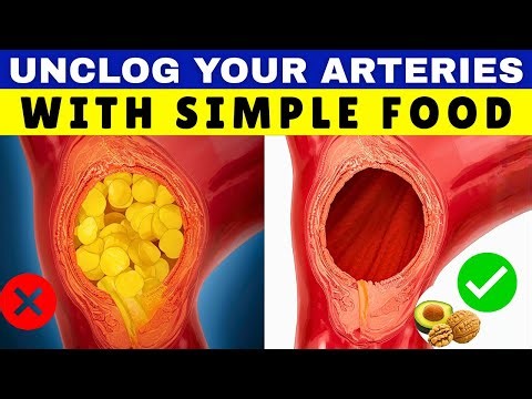 5 Simple Habits for a Stronger Heart and Unclogged Arteries