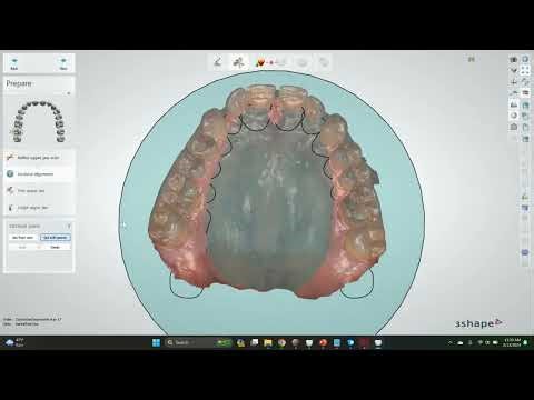 How to create a blockout model in 3shape - DentalTechTips