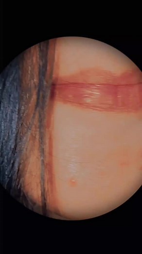 Exploring Glossy Lips in Close-Up Video