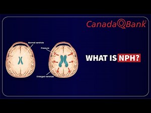 Normal Pressure Hydrocephalus Explained | Triad, Diagnosis & Treatment | CanadaQBank