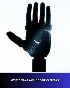 20K views · 284 reactions | A new prosthetic from a US-based firm offers 32 grip patterns, real touch sensation, lightning-fast 200ms closing speed, and smart app controls. Lightweight, splash-resistant, and widely compatible, it’s changing how prosthetics feel and function. | Startup Selfie | Facebook