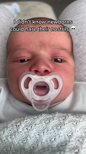 Baby Nostrils Flaring: A Surprising Newborn Behavior