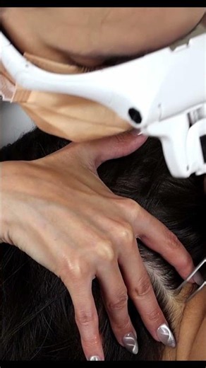 ASMR Removing LICE from Her Scalp | School Nurse Lice Check with Tweezers and Nails #shorts #asmr