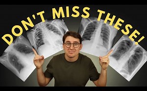 Chest X-ray review areas(1080P_HD)