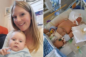 My baby was born without an anus — I thought he was dying but we saved his life
