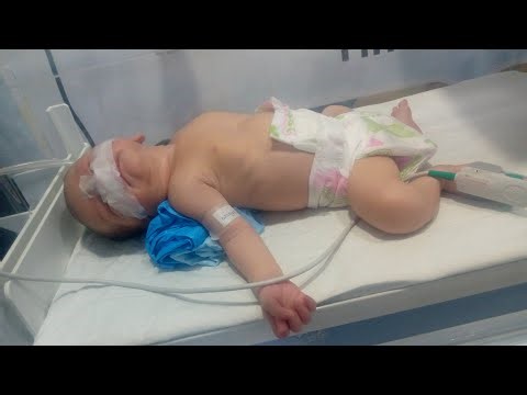 Care of neonates499 is live Critical baby with Severe Respiratory Distress SpO₂54%On Take-Up Support