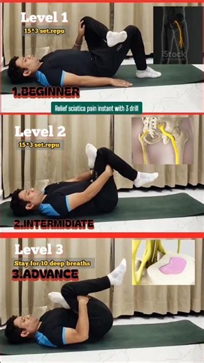 🌿 Figure-4 Stretch (3 Levels) for Sciatica🔥 #yoga #nonfollowers