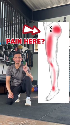 Relieve Iliotibial Band Syndrome Pain with Effective Stretches