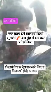 A Cotton Bomb Was Exploded In Mouth