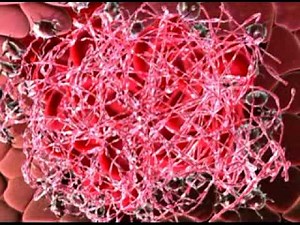 Cascada coagulación