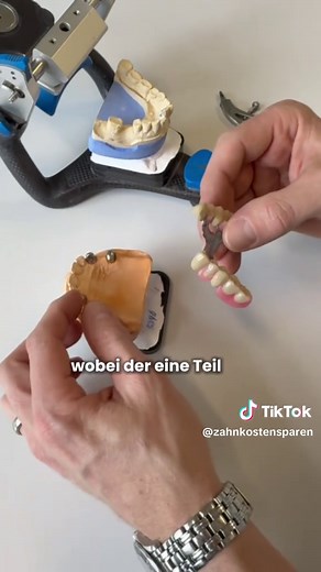 Oberkiefer-Teleskopprothese: Effizienter Zahnersatz