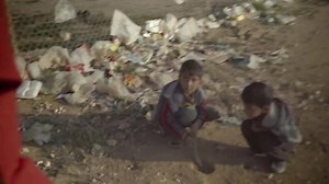 34K views · 1K reactions | The world’s forgotten children need us:...