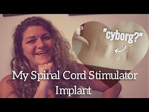 Nevro Spinal Cord Stimulator Implant Surgery (at 21 Years Old) | Young Chronic Pain [CC]
