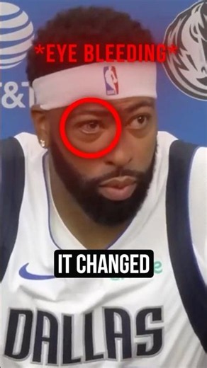 An NBA Star Is Going BLIND?!?!