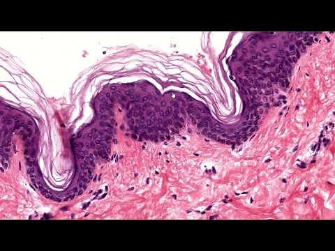 Histology of: Stratified cornified squamous epithelium - Express ;)