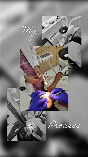 Process of braces