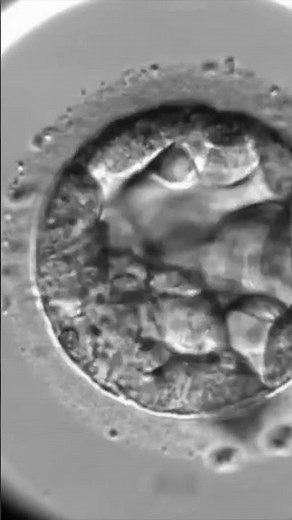 ✨ Así comienza la vida: cavitación embrionaria ✨