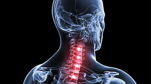 Neck Pain