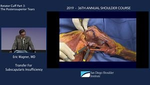 Tendon Transfer For Subscapularis Insufficiency: Expanding Indications
